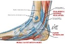 In this medical illustration of the foot and ankle, the medial plantar artery and nerve, tibial nerve and posterior tibial artery, and flexor retinaculum are highlighted to show the tendons and anatomy of the foot and ankle. 